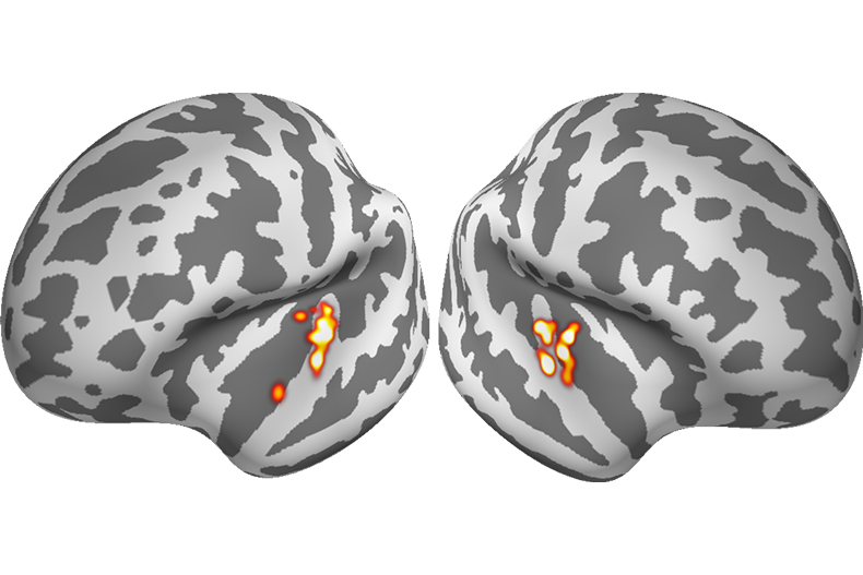 Spatial location of brain responses to attended target sounds embedded in noise.