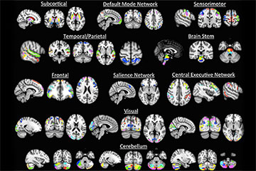 100 individual brain areas