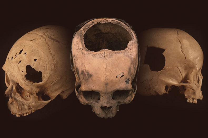 Holes in the Head 940