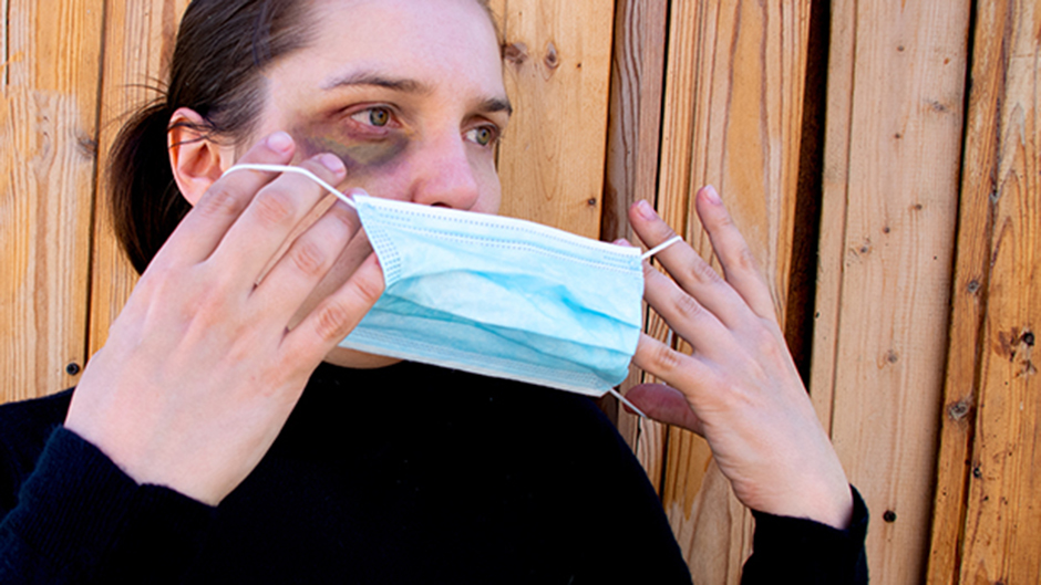 Woman with a bruised eye putting on a face mask